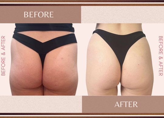 Before and After Minimal Photocentric facebook post (940 x 688 px)